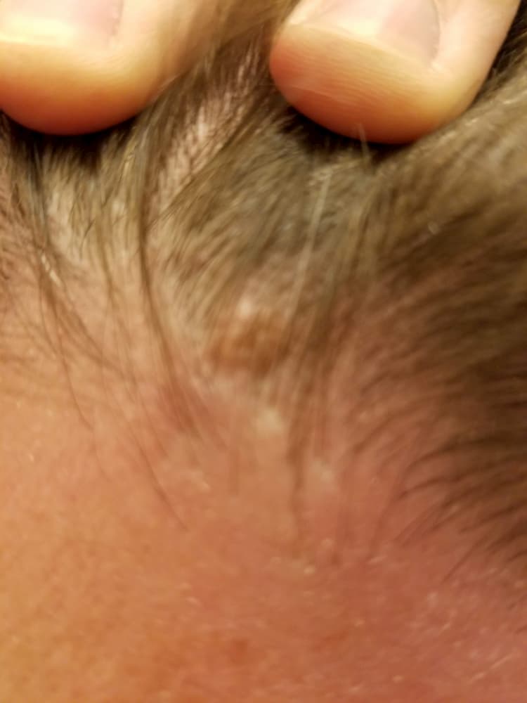 My Test Run of Medical Service in Panama Went Awry - Mole on My Head